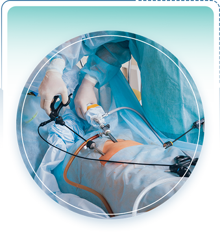 Laparoscopic Surgery in Ballari