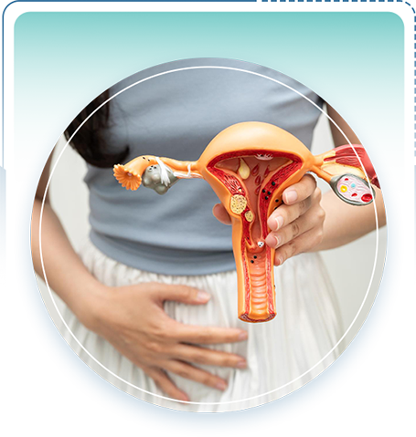 PCOS Specialist in ballari